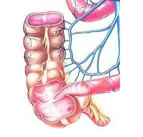 阑尾炎怎么治疗